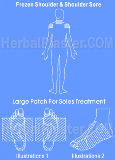 Herbal Patch for frozen shoulder pain treatment therapy, cures for shoulder pain, sore, soreness, neck pain, blade pain, shoulder arm pain and joint pain