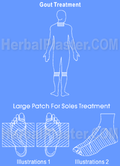 Herbal Patch for gout natural treatment home remedy, cures for gout natural remedy, gout attack home treatment, gout pain relief for gout foot arthritis