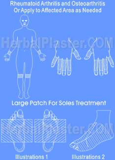 Herbal patch for rheumatoid arthritis treatment, the natural arthritis pain relief remedy through the unique aspects of pain reduction in osteoarthritis knee joint
