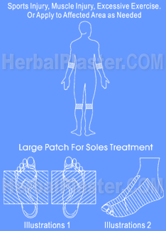 Herbal patch for sports injuries, excessive exercise, common muscle pain, sore, cramp & strain natural treatment, the best alternative sports medicine