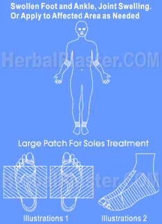 Herbal patches home treatment for swollen feet, ankles, hands, leg, knee & feet, the natural remedies for swelling tendon achilles, edema feet, bunions