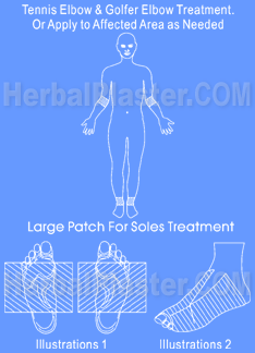 Tennis elbow treatment through herbal patch, natural tennis elbow cure therapy remedy, relief & recover tennis elbow pain injuries joint golfers naturally